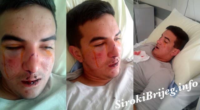 Ilustracija članka: Pismo majke pretučenog dječaka iz Širokog Brijega