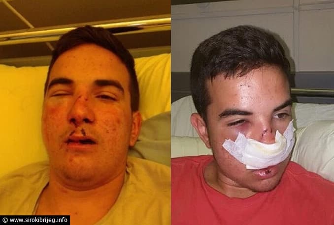 Ilustracija članka: Završena istraga: ‘Mile Soldo nije pretučen’