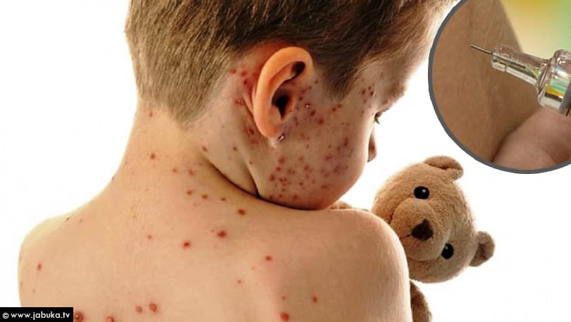 Ilustracija članka: Cijepljenje djece opalo, postoji mogućnost epidemije ospica u FBiH