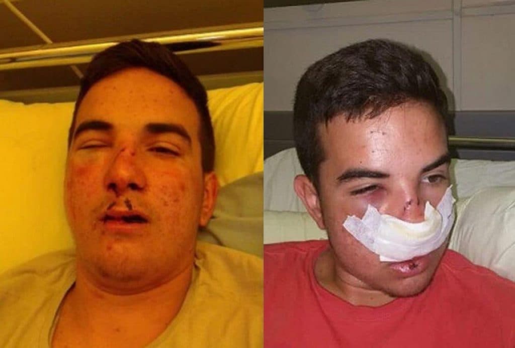 Ilustracija članka: Tužiteljstvo ŽZH obustavilo istragu: Mile Soldo se sam ozlijedio!