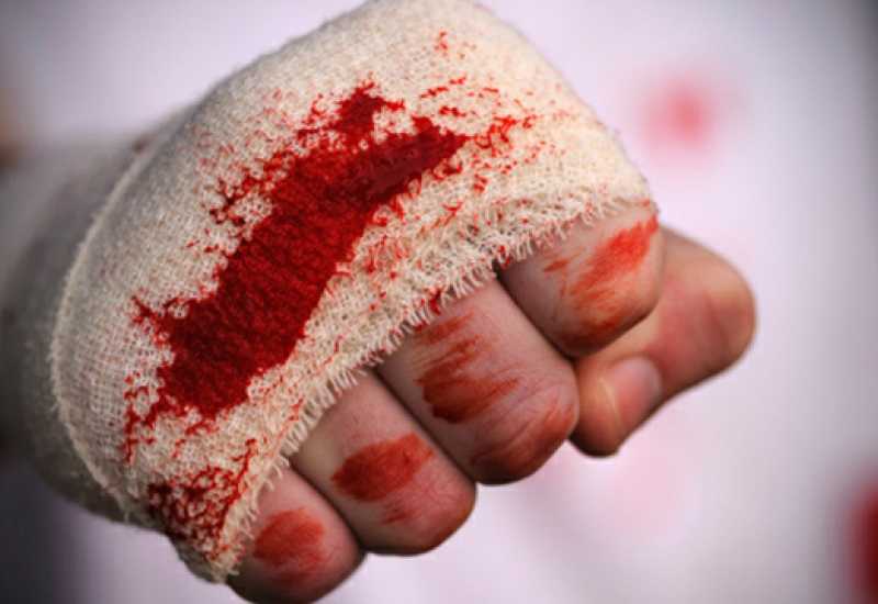 Ilustracija članka: Bivši načelnik Čapljine Pero Marković pretučen u središtu grada