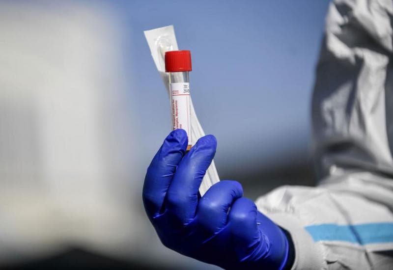 Ilustracija članka: ŽZH i HBŽ dobit će po 600 testova