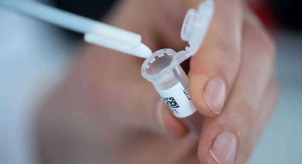 Ilustracija članka: Nestat će komercijalnih testova na Covid u BiH?