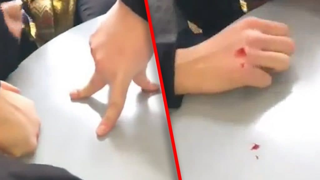 Ilustracija članka: Igra “krvavi novčić” sve popularnija među dječacima u Hercegovini