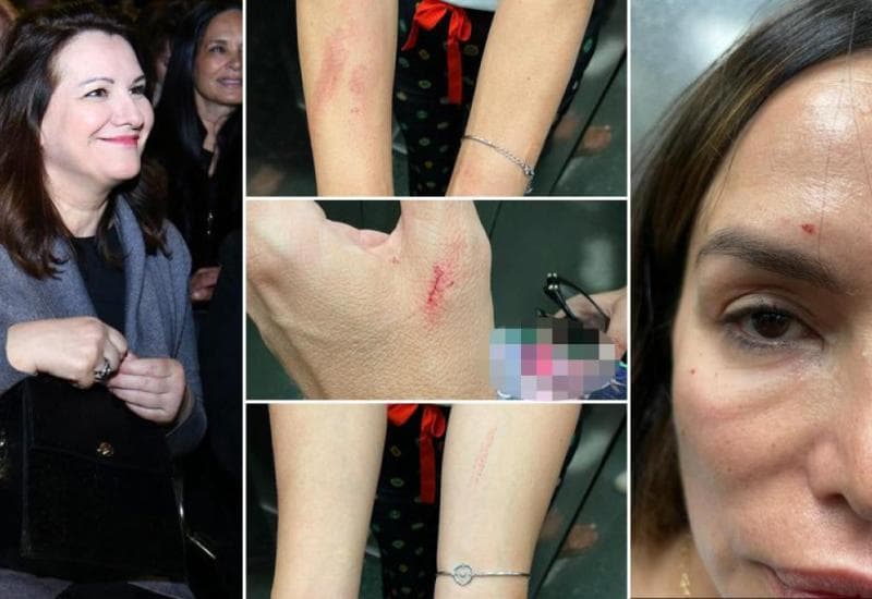 Ilustracija članka: Severina uhićena zbog fizičkog sukoba