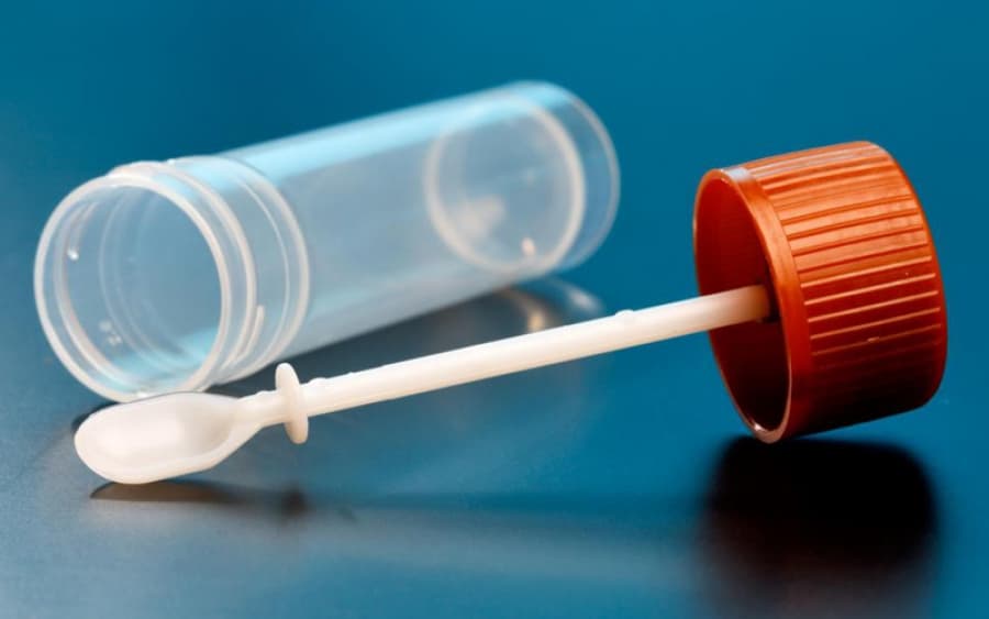 Ilustracija članka: ŽZH: Preuzmite besplatne testove za otkrivanje nevidljive krvi u stolici