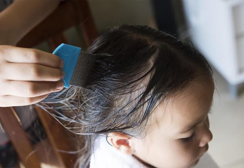 Ilustracija članka: Zaraza ušima kod djece sve raširenija u vrtićima u Hercegovini