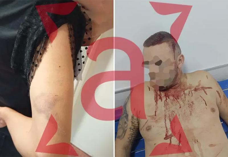 Ilustracija članka: Trebinje: Pretukli obitelj jer ih je prijavila zbog pucnjave na svadbi