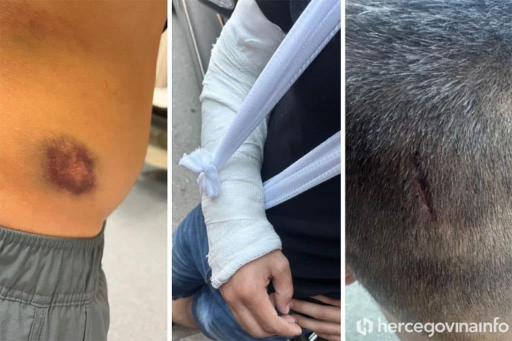 Ilustracija članka: Pretučeni mladići iz Širokog Brijega idu na saslušanje