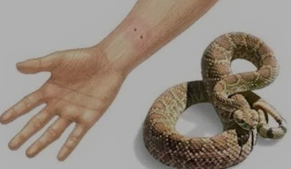 Ilustracija članka: VIDEO: Što trebate napraviti ako vas ugrize zmija?