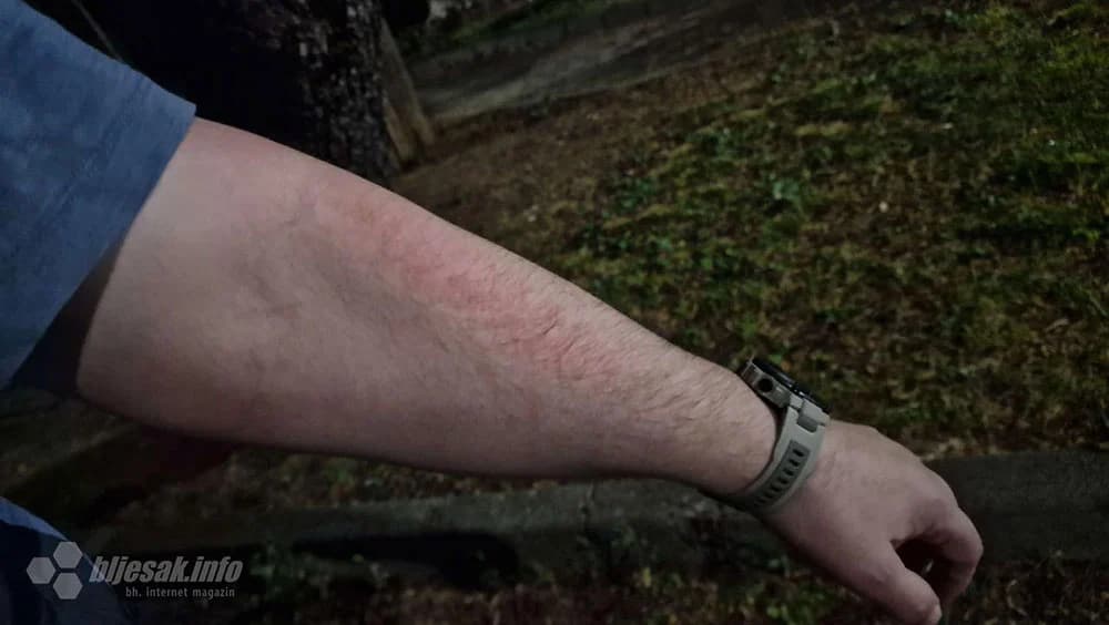 Ilustracija članka: Mostar: Policajac pendrekom pretukao novinara zbog psa